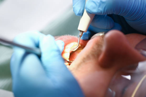 Best Emergency Treatment for Toothache in Uhland, TX