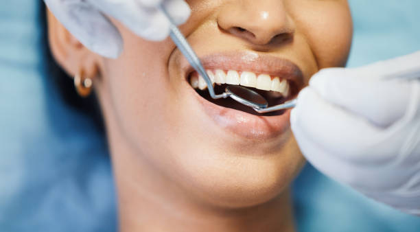 Best Emergency Dental Care for Trauma or Injury in Uhland, TX