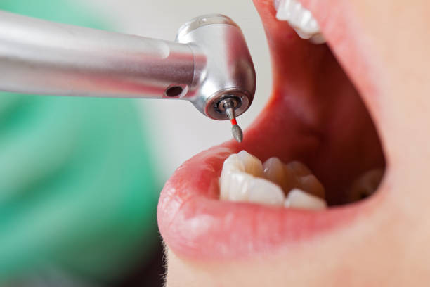Best After-Hours Emergency Dentist in Uhland, TX